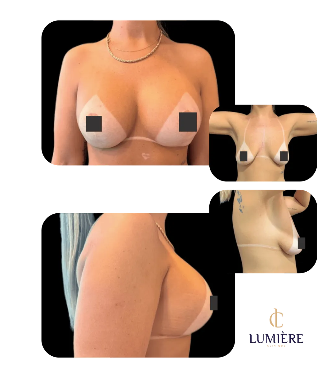 Resultado real de paciente da Lumière