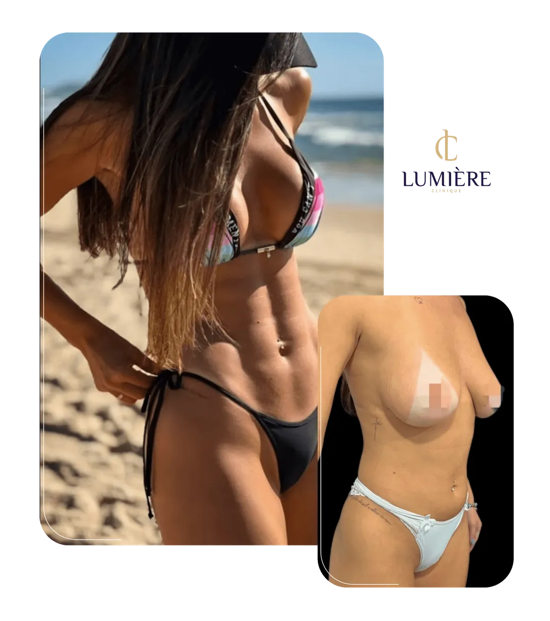 Resultado real de paciente da Lumière
